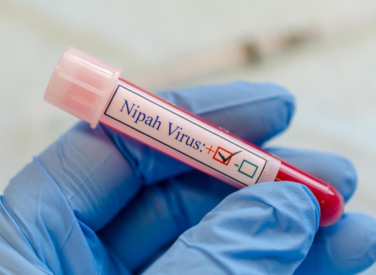 Nipah : début d'épidémie et 1er décès lié au virus en Inde