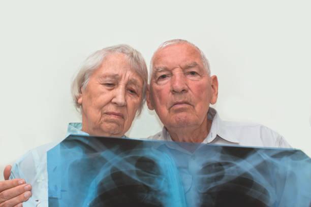 PhenoAgeAccel : un index de vieillissement accéléré permettant de prédire le risque d’avoir une maladie respiratoire.