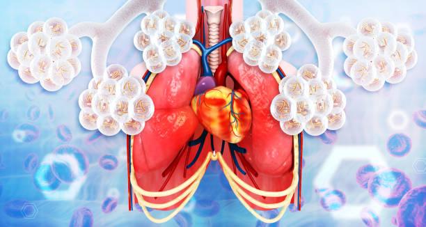 Fibrose pulmonaire idiopathique : négativité de  l’étude de phase 3 sur la zinpentraxine alpha
